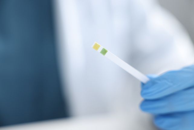 Drogentest 
